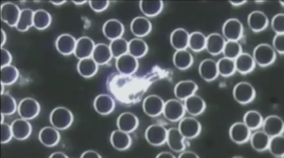 Cellular cleanse - Ideal blood cells