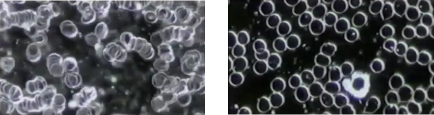 Cellular cleanse - Too much meat