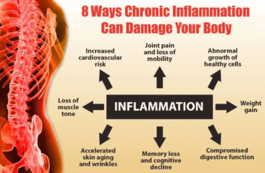Chronic Inflammation
